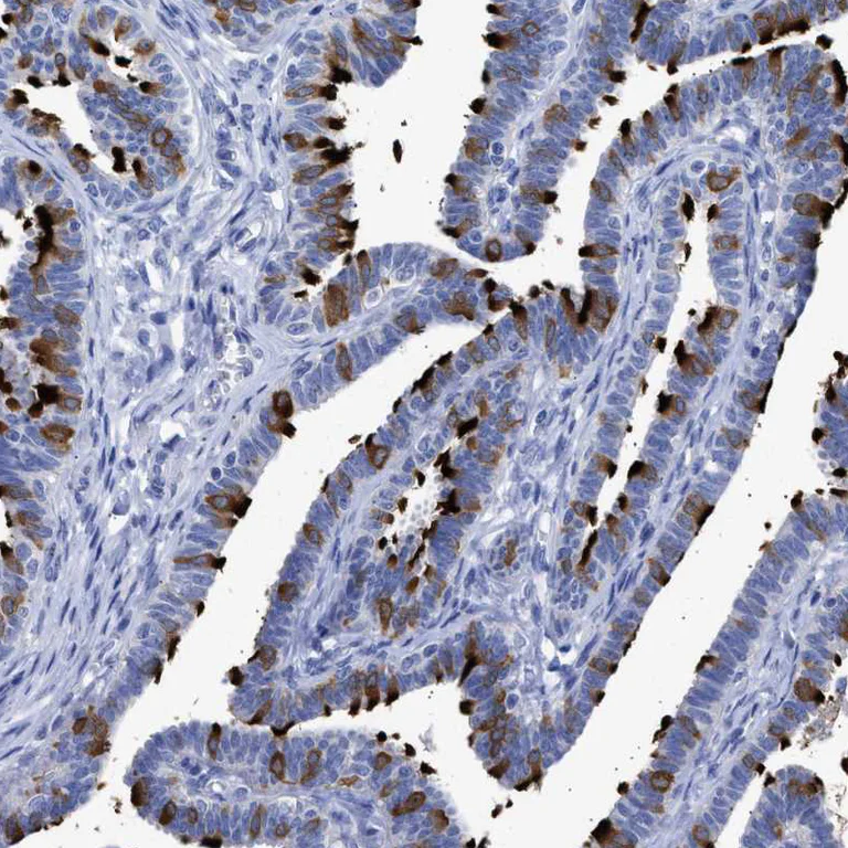Immunohistochemistry (Formalin/PFA-fixed paraffin-embedded sections) - Anti-TSGA2 antibody (AB224104)