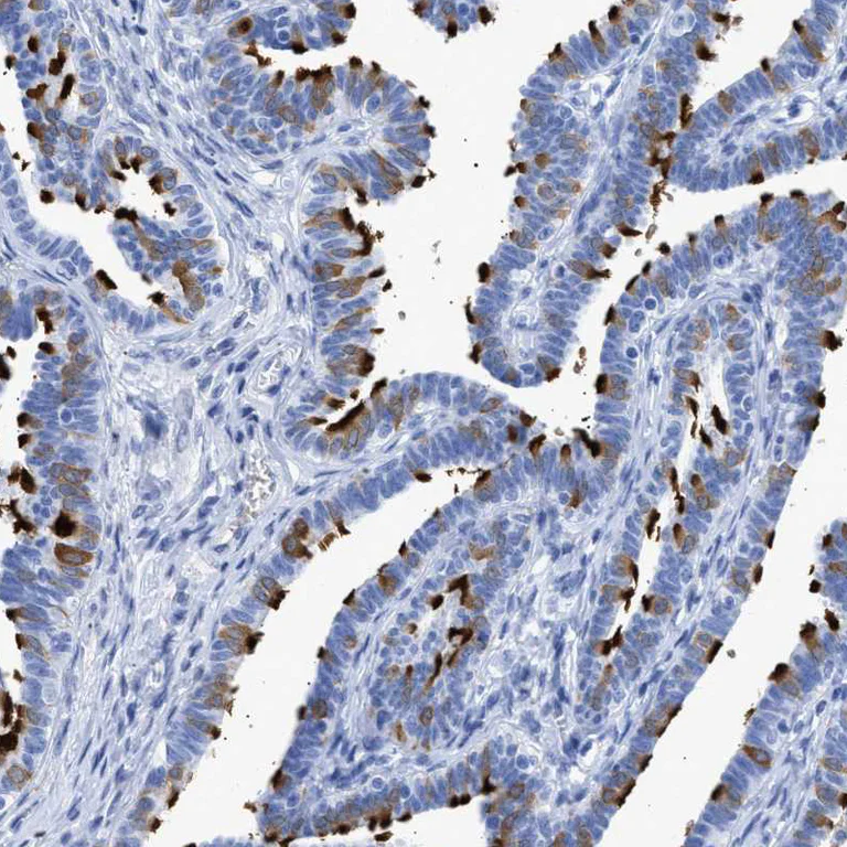 Immunohistochemistry (Formalin/PFA-fixed paraffin-embedded sections) - Anti-TSGA2 antibody (AB224386)