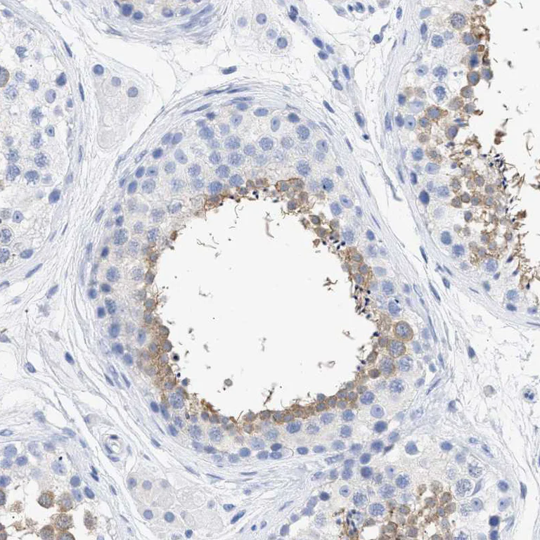 Immunohistochemistry (Formalin/PFA-fixed paraffin-embedded sections) - Anti-TSGA2 antibody (AB224386)