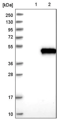 Western blot - Anti-TSGA2 antibody (AB224386)