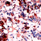 Immunohistochemistry (Formalin/PFA-fixed paraffin-embedded sections) - Anti-TSH antibody (AB64378), expandable thumbnail
