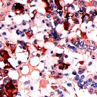 Immunohistochemistry (Formalin/PFA-fixed paraffin-embedded sections) - Anti-TSH antibody (AB64378)