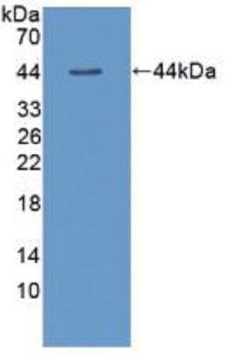 Western blot - Anti-TSH beta antibody (AB231218), expandable thumbnail