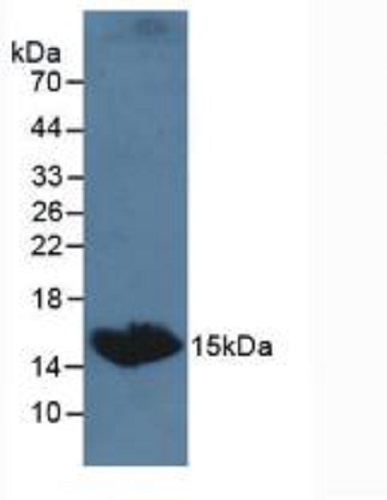 Western blot - Anti-TSH beta antibody (AB231218), expandable thumbnail