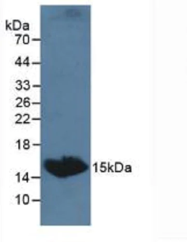 Western blot - Anti-TSH beta antibody (AB231218)