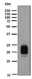 Western blot - Anti-TSH beta antibody [EPR8197] - BSA and Azide free (AB249214), expandable thumbnail
