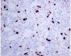 Immunohistochemistry (Formalin/PFA-fixed paraffin-embedded sections) - Anti-TSH beta antibody [EPR8198] (AB155958)