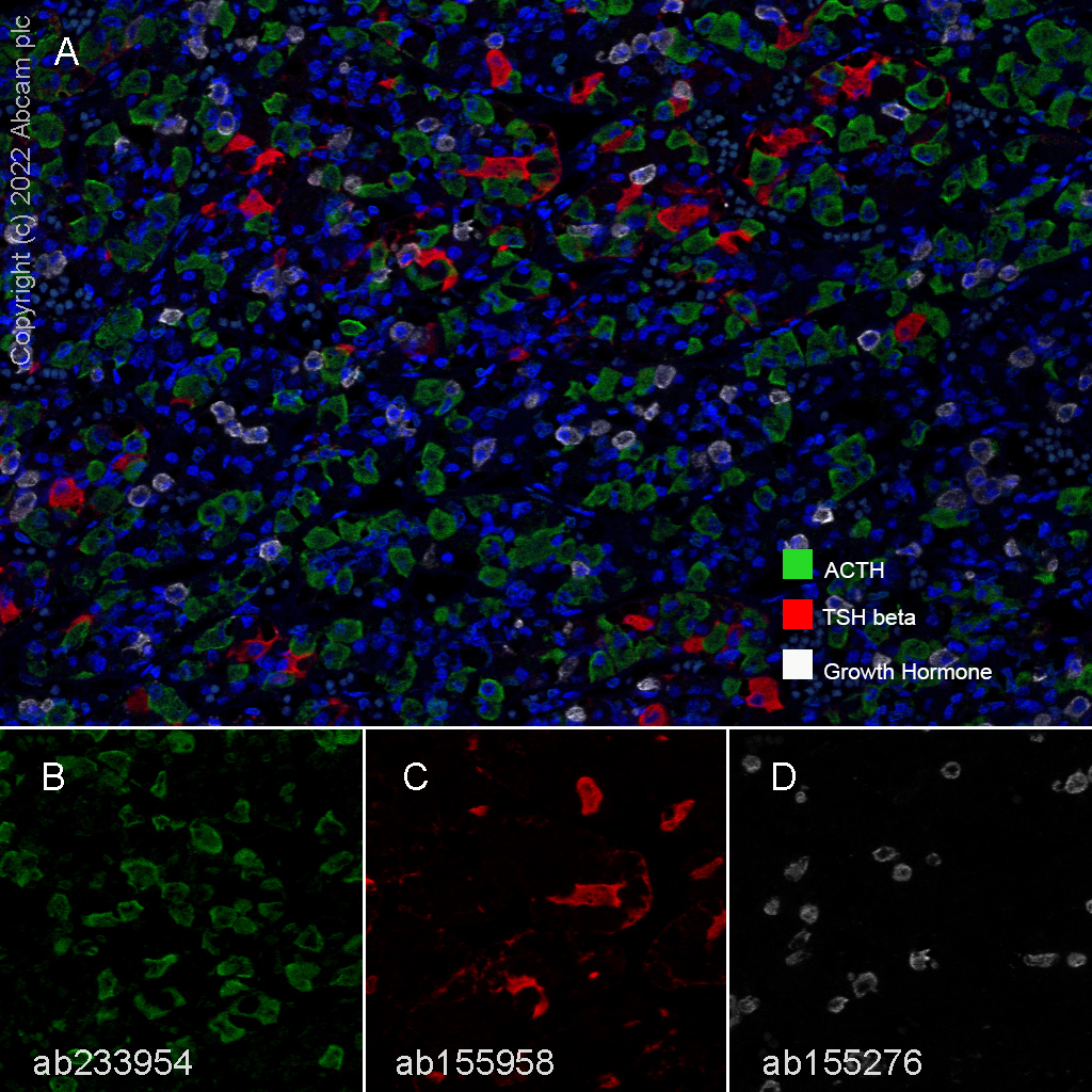 Multiplex immunohistochemistry - Anti-TSH beta antibody [EPR8198] (AB155958), expandable thumbnail
