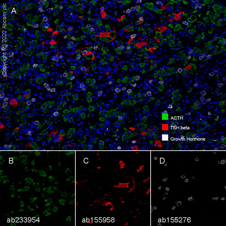 Multiplex immunohistochemistry - Anti-TSH beta antibody [EPR8198] (AB155958)