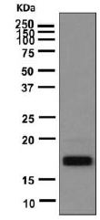 Western blot - Anti-TSH beta antibody [EPR8198] (AB155958), expandable thumbnail