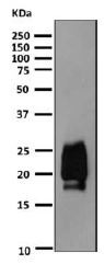 Western blot - Anti-TSH beta antibody [EPR8198] (AB155958), expandable thumbnail