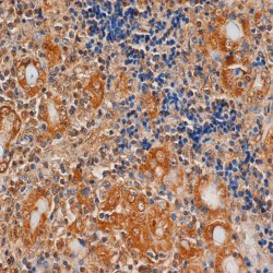 Immunohistochemistry (Formalin/PFA-fixed paraffin-embedded sections) - Anti-TSH Receptor/TSH-R antibody [4C1] (AB27974)