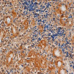 Immunohistochemistry (Formalin/PFA-fixed paraffin-embedded sections) - Anti-TSH Receptor/TSH-R antibody [4C1] (AB27974)
