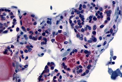 Immunohistochemistry (Formalin/PFA-fixed paraffin-embedded sections) - Anti-TSH Receptor/TSH-R antibody - C-terminal (AB188902)