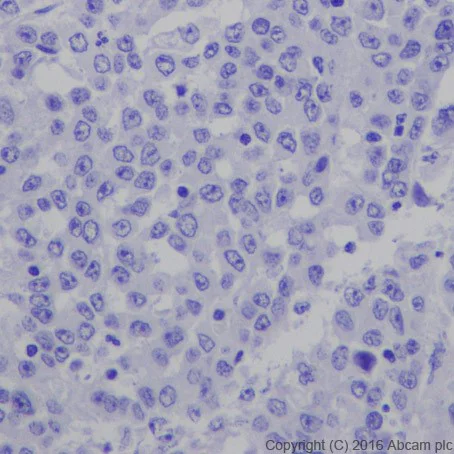 Immunohistochemistry (Formalin/PFA-fixed paraffin-embedded sections) - Anti-TSH Receptor/TSH-R antibody [EPR19751] (AB218108)
