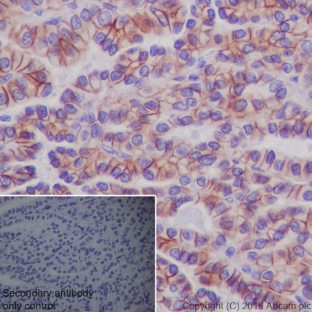 Immunohistochemistry (Formalin/PFA-fixed paraffin-embedded sections) - Anti-TSH Receptor/TSH-R antibody [EPR19751] - BSA and Azide free (AB251559), expandable thumbnail