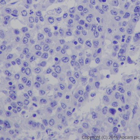 Immunohistochemistry (Formalin/PFA-fixed paraffin-embedded sections) - Anti-TSH Receptor/TSH-R antibody [EPR19751] - BSA and Azide free (AB251559), expandable thumbnail