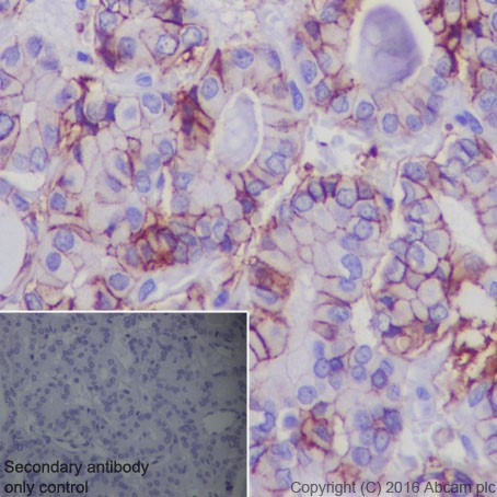 Immunohistochemistry (Formalin/PFA-fixed paraffin-embedded sections) - Anti-TSH Receptor/TSH-R antibody [EPR19751] - BSA and Azide free (AB251559), expandable thumbnail