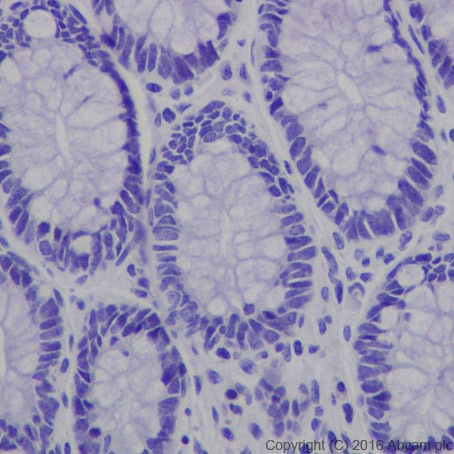 Immunohistochemistry (Formalin/PFA-fixed paraffin-embedded sections) - Anti-TSH Receptor/TSH-R antibody [EPR19751] - BSA and Azide free (AB251559), expandable thumbnail