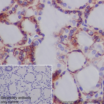 Immunohistochemistry (Formalin/PFA-fixed paraffin-embedded sections) - Anti-TSH Receptor/TSH-R antibody [EPR19751] - BSA and Azide free (AB251559), expandable thumbnail