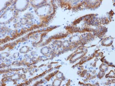 Immunohistochemistry (Formalin/PFA-fixed paraffin-embedded sections) - Anti-TSH Receptor/TSH-R antibody [SPM222] (AB218329)