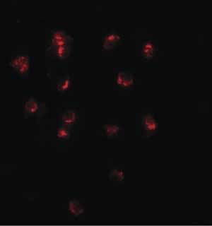 Immunocytochemistry/ Immunofluorescence - Anti-TSHZ1 antibody (AB140196)