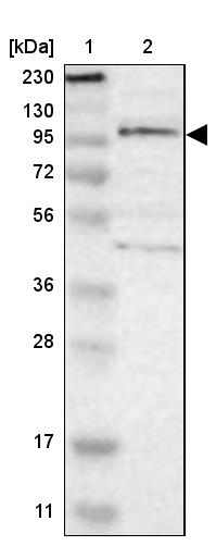 Western blot - Anti-TSHZ1 antibody (AB254619), expandable thumbnail