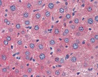Immunohistochemistry (Formalin/PFA-fixed paraffin-embedded sections) - Anti-TSLP antibody (AB115700)