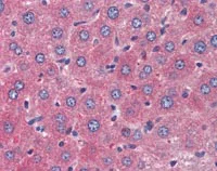 Immunohistochemistry (Formalin/PFA-fixed paraffin-embedded sections) - Anti-TSLP antibody (AB115700)