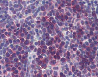 Immunohistochemistry (Formalin/PFA-fixed paraffin-embedded sections) - Anti-TSLP antibody (AB115700)