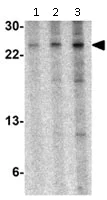 Western blot - Anti-TSLP antibody (AB115700)