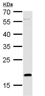 Western blot - Anti-TSLP antibody (AB184638), expandable thumbnail