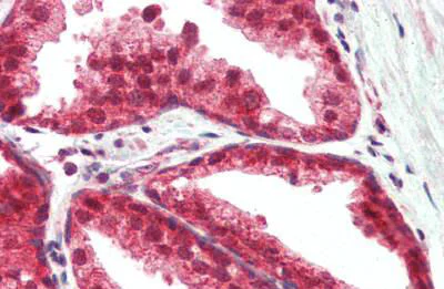 Immunohistochemistry (Formalin/PFA-fixed paraffin-embedded sections) - Anti-TSLP antibody (AB188766)