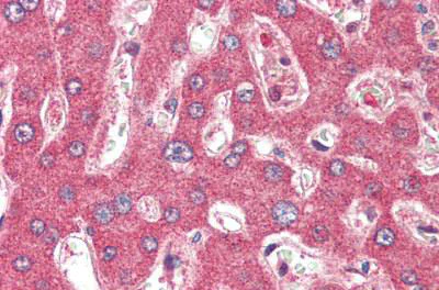 Immunohistochemistry (Formalin/PFA-fixed paraffin-embedded sections) - Anti-TSLP antibody (AB188766)