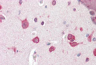 Immunohistochemistry (Formalin/PFA-fixed paraffin-embedded sections) - Anti-TSLP antibody (AB188766)