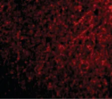 Immunohistochemistry (Formalin/PFA-fixed paraffin-embedded sections) - Anti-TSLP antibody (AB188766)