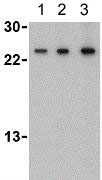 Western blot - Anti-TSLP antibody (AB188766)