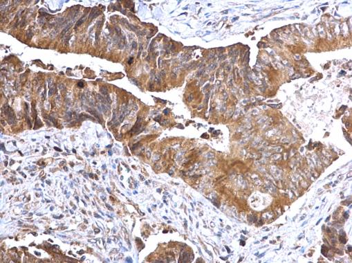 Immunohistochemistry (Formalin/PFA-fixed paraffin-embedded sections) - Anti-TSLP antibody (AB229251)