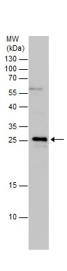 Western blot - Anti-TSLP antibody (AB229251)