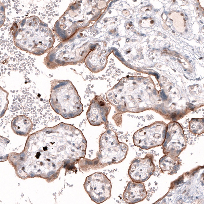 Immunohistochemistry (Formalin/PFA-fixed paraffin-embedded sections) - Anti-Tspan-13 antibody (AB121262), expandable thumbnail
