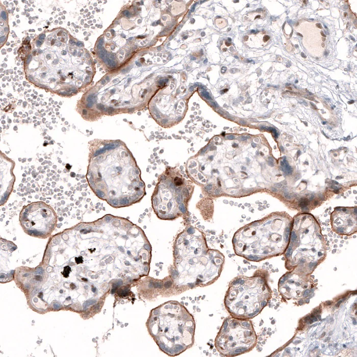 Immunohistochemistry (Formalin/PFA-fixed paraffin-embedded sections) - Anti-Tspan-13 antibody (AB121262)