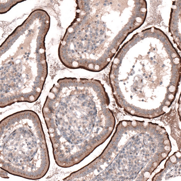 Immunohistochemistry (Formalin/PFA-fixed paraffin-embedded sections) - Anti-Tspan-13 antibody (AB121262), expandable thumbnail