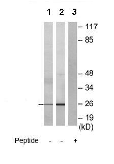 Western blot - Anti-Tspan-8 antibody (AB70007)