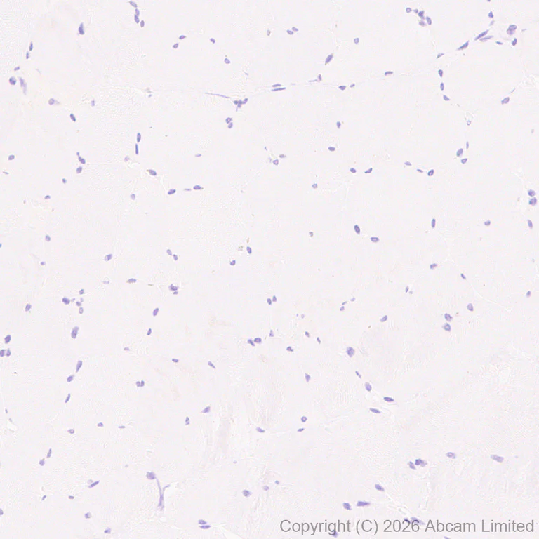 Immunohistochemistry (Formalin/PFA-fixed paraffin-embedded sections) - Anti-Tspan-8 antibody [EPR28888-508] - BSA and Azide free (AB326573)