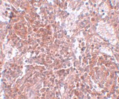 Immunohistochemistry (Formalin/PFA-fixed paraffin-embedded sections) - Anti-Tspan-9 antibody (AB106412)