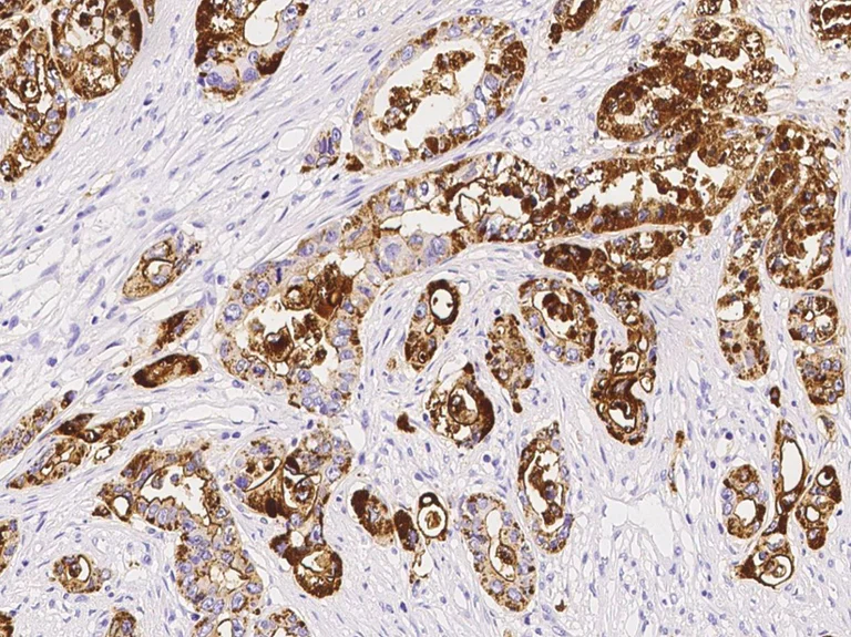 Immunohistochemistry (Formalin/PFA-fixed paraffin-embedded sections) - Anti-TSPAN1 antibody [010] - BSA and Azide free (AB276063)