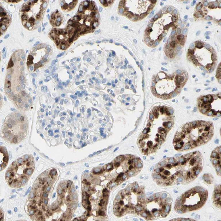 Immunohistochemistry (Formalin/PFA-fixed paraffin-embedded sections) - Anti-TSPAN1 antibody (AB254730)