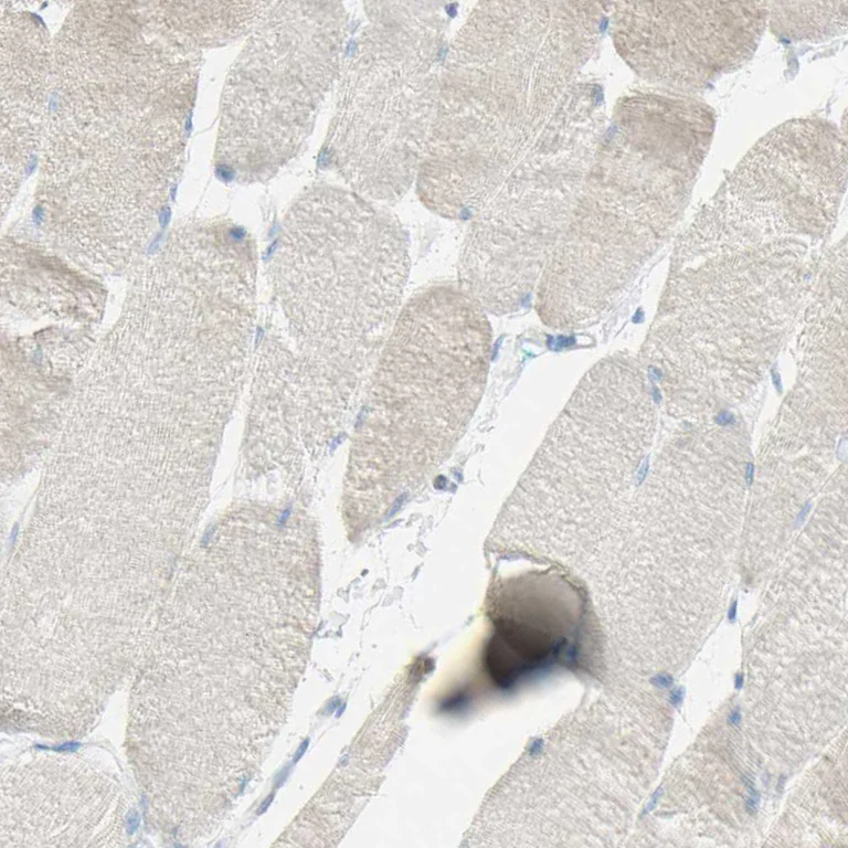 Immunohistochemistry (Formalin/PFA-fixed paraffin-embedded sections) - Anti-TSPAN1 antibody (AB254730)