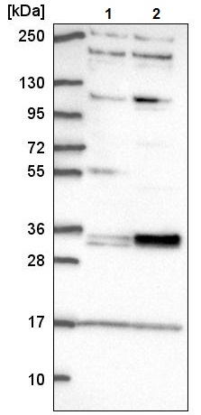 Western blot - Anti-TSPAN11 antibody (AB221740), expandable thumbnail