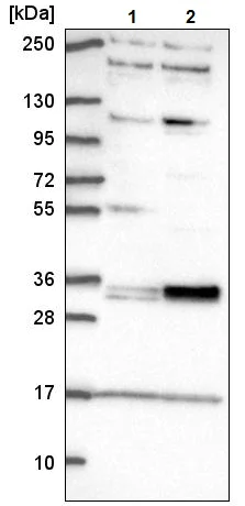 Western blot - Anti-TSPAN11 antibody (AB221740)